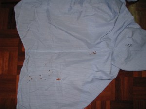 Acid Eaten Shirt